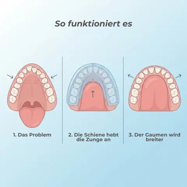 Vyroon Milu™ – Die Nachtschiene für Kinder
